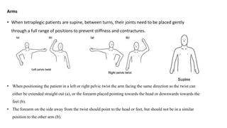 Arms
• When tetraplegic patients are supine, between turns, their joints need to be placed gently
through a full range of positions to prevent stiffness and contractures.
• When positioning the patient in a left or right pelvic twist the arm facing the same direction as the twist can
either be extended straight out (a), or the forearm placed pointing towards the head or downwards towards the
feet (b).
• The forearm on the side away from the twist should point to the head or feet, but should not be in a similar
position to the other arm (b).
 