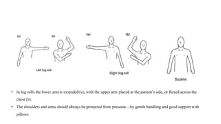 • In log rolls the lower arm is extended (a), with the upper arm placed at the patient’s side, or flexed across the
chest (b).
• The shoulders and arms should always be protected from pressure—by gentle handling and good support with
pillows
 