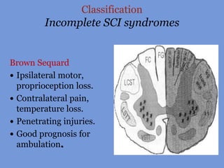 Classification
Incomplete SCI syndromes
Brown Sequard
 Ipsilateral motor,
proprioception loss.
 Contralateral pain,
temperature loss.
 Penetrating injuries.
 Good prognosis for
ambulation.
 