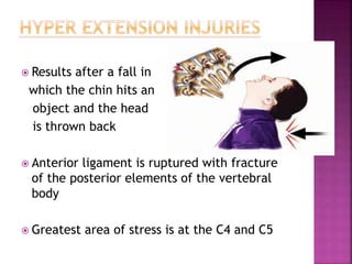  Results after a fall in
which the chin hits an
object and the head
is thrown back
 Anterior ligament is ruptured with f...