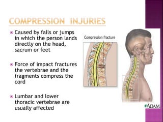  Caused by falls or jumps
in which the person lands
directly on the head,
sacrum or feet
 Force of impact fractures
the ...