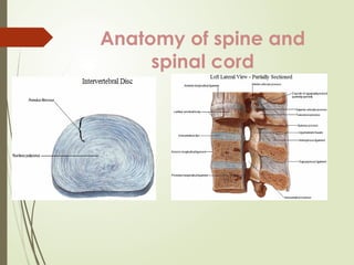 Management of a patient with spine and spinal cord injury | PPTX