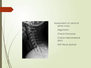 Inspect Spinal Alignment Management of a patient with spine and spinal cord injury | PPTX