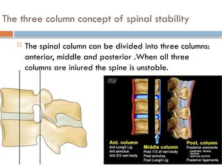 The three column concept of spinal stability
 The spinal column can be divided into three columns:
anterior, middle and posterior .When all three
columns are injured the spine is unstable.
 