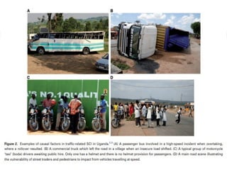 Spinal Cord Injury Lecture Presentation for Medical Students.