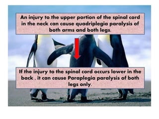 Spinal Cord Injury Lecture Presentation for Medical Students.