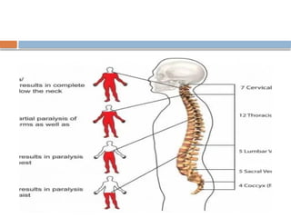 Spinal Cord Injury Lecture Presentation for Medical Students.