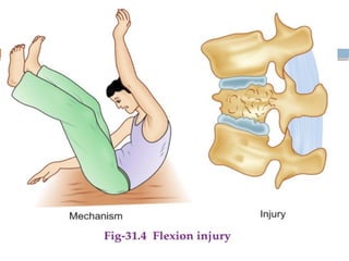 Spinal Cord Injury Lecture Presentation for Medical Students.