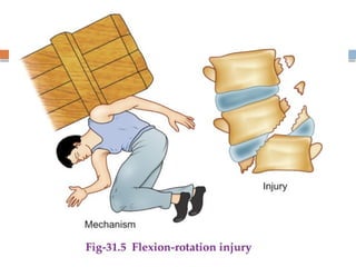 Spinal Cord Injury Lecture Presentation for Medical Students.