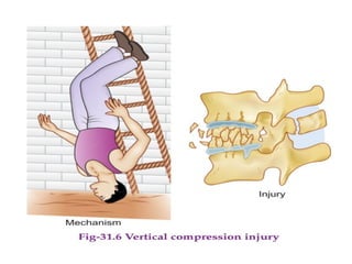 Spinal Cord Injury Lecture Presentation for Medical Students.