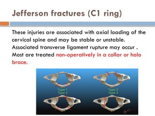 Jefferson fractures (C1 ring)
These injuries are associated with axial loading of the
cervical spine and may be stable or unstable.
Associated transverse ligament rupture may occur .
Most are treated non-operatively in a collar or halo
brace.
 