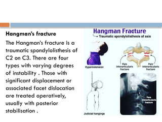 Hangman’s fracture
The Hangman’s fracture is a
traumatic spondylolisthesis of
C2 on C3. There are four
types with varying degrees
of instability . Those with
significant displacement or
associated facet dislocation
are treated operatively,
usually with posterior
stabilisation .
 