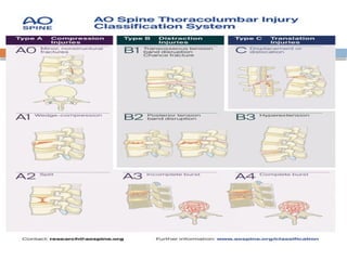 Spinal Cord Injury Lecture Presentation for Medical Students.