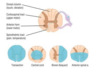 Spinal Cord Injury Lecture Presentation for Medical Students.
