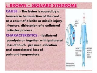 Spinal Cord Injury Lecture Presentation for Medical Students.