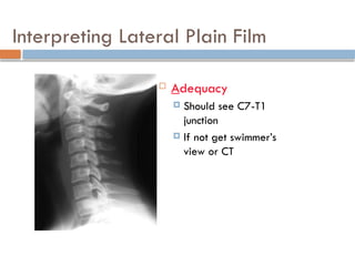 Interpreting Lateral Plain Film
 Adequacy
 Should see C7-T1
junction
 If not get swimmer’s
view or CT
 