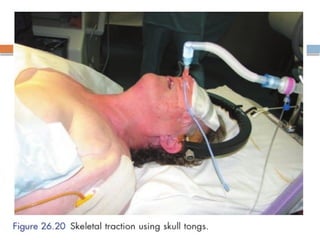 Spinal Cord Injury Lecture Presentation for Medical Students.