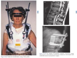 Spinal Cord Injury Lecture Presentation for Medical Students.