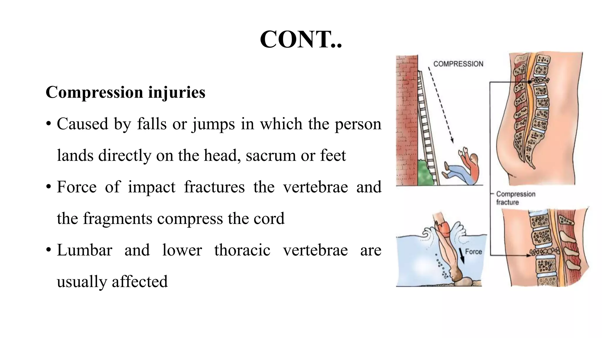 Spinal cord injury_040036.pptx | Death, Injury, or Military Conflict ...