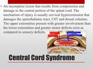 Cst Compression Injury Spinal cord injury 2012 intern | PPTX