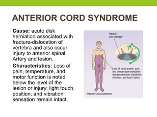 ANTERIOR CORD SYNDROME
• Cause: acute disk
herniation associated with
fracture-dislocation of
vertebra and also occur
injury to anterior spinal
Artery and lesion.
• Characteristics: Loss of
pain, temperature, and
motor function is noted
below the level of the
lesion or injury; light touch,
position, and vibration
sensation remain intact.
 
