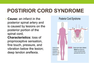 POSTIRIOR CORD SYNDROME
• Cause: an infarct in the
posterior spinal artery and
is caused by lesions on the
posterior portion of the
spinal cord,
Characteristics: loss of
proprioceptive sensation,
fine touch, pressure, and
vibration below the lesion;
deep tendon areflexia.
 