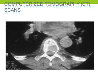 COMPUTERIZED TOMOGRAPHY (CT)
SCANS
 