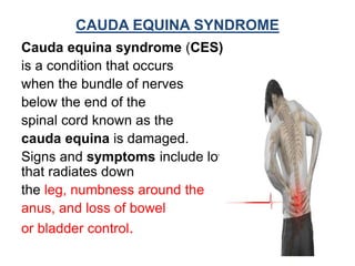 Spinal Cord Injuries | PPTX