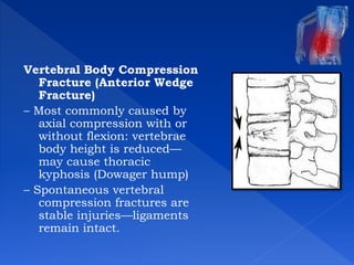 Spinal cord injury rehabilitation | PPTX