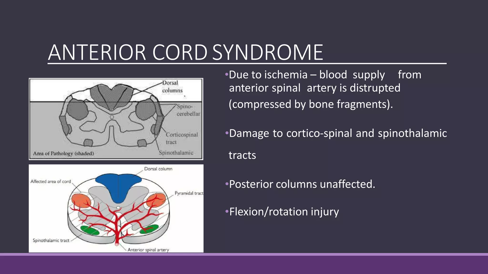 spinalcordinjury short version.pptx