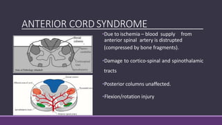BROWN-SEQUARDSYNDROME
•Hemisection of the cord
•Usually in penetrating trauma,
Knife in back or
rotational or fracture/dis...