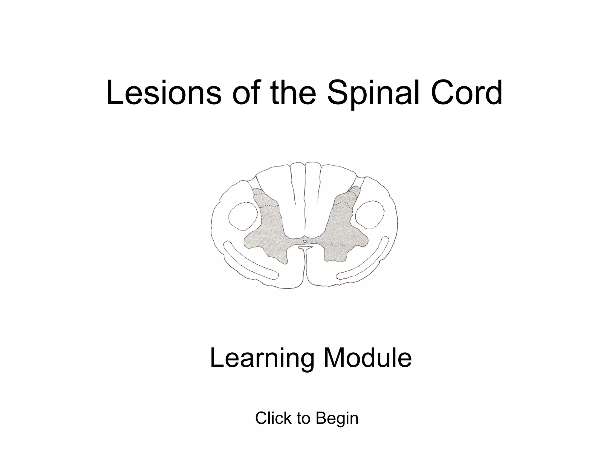 Spinal cord lesions module | PPS