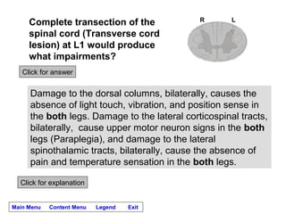 R       L
     Complete transection of the
     spinal cord (Transverse cord
     lesion) at L1 would produce
     what impairments?
   Click for answer


     Damage to the dorsal columns, bilaterally, causes the
     absence of light touch, vibration, and position sense in
     the both legs. Damage to the lateral corticospinal tracts,
     bilaterally, cause upper motor neuron signs in the both
     legs (Paraplegia), and damage to the lateral
     spinothalamic tracts, bilaterally, cause the absence of
     pain and temperature sensation in the both legs.

  Click for explanation


Main Menu   Content Menu   Legend   Exit
 
