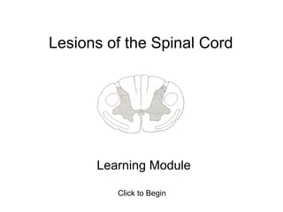 Lesions of the Spinal Cord




      Learning Module

         Click to Begin
 