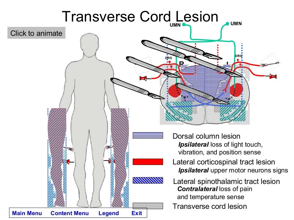 Spinal cord lesions module