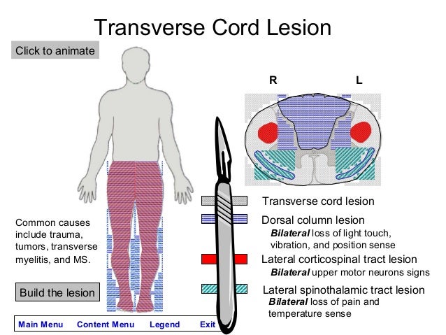Spinal Lesions Symptoms