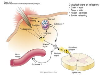 Classical signs of infection:
•   Calor – heat
•   Dolor – pain
•   Rubor – redness
•   Tumor - swelling




                       9
 