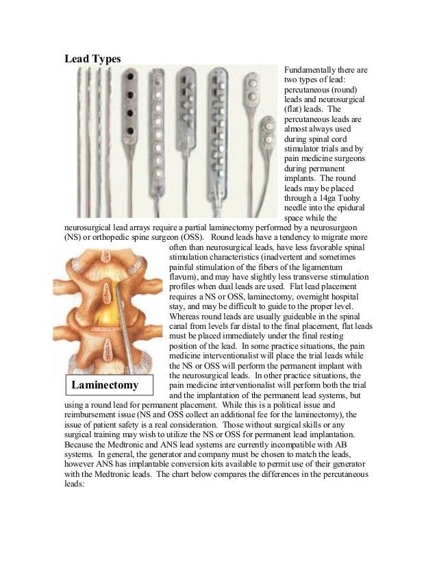 Spinal Cord Stimulation Primer