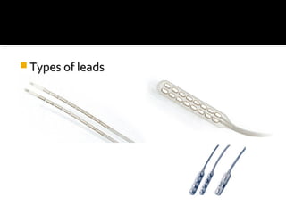  Types of leadsTypes of leads
 