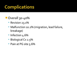  Overall 30-40%
 Revision 23.1%
 Malfunction 10.2% (migration, lead failure,
breakage)
 Infection 4.6%
 Biological Cx 2.5%
 Pain at PG site 5.6%
 