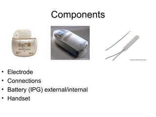 Components Electrode Connections Battery (IPG) external/internal Handset 