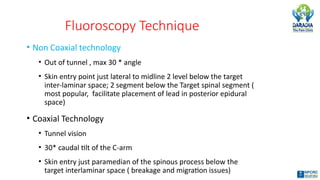 Fluoroscopy Technique
• Non Coaxial technology
• Out of tunnel , max 30 * angle
• Skin entry point just lateral to midline 2 level below the target
inter-laminar space; 2 segment below the Target spinal segment (
most popular, facilitate placement of lead in posterior epidural
space)
• Coaxial Technology
• Tunnel vision
• 30* caudal tilt of the C-arm
• Skin entry just paramedian of the spinous process below the
target interlaminar space ( breakage and migration issues)
 