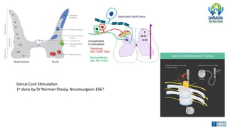 Comprehensive Overview of Spinal Cord Stimulation for Pain Management ...