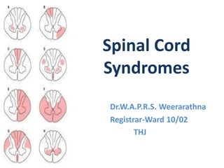 Spinal Cord
Syndromes
Dr.W.A.P.R.S. Weerarathna
Registrar-Ward 10/02
THJ
 