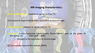 MR Imaging characteristics:
 Iso or hypointense relative to spinal cord on T1.
 Occasional hyperintense mass secondary to hemorrhage.
 Hyperintense relative to spinal cord on T2.
 Cap sign, a rim of extreme hypointensity (hemosiderin) seen at the poles of
the tumor on T2W (20%—30%)
…. thought to be secondary to hemorrhage.
 Cord edema around the masses (60%).
Dodul Mondal
 