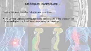 Craniospinal Irradiation cont..
• one of the most complex radiotherapy techniques
• The CTV for CSI has an irregular shape that consists of the whole of the
brain and spinal cord and overlying meningeal coverings
Dodul Mondal
 
