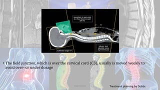 • The field junction, which is over the cervical cord (C3), usually is moved weekly to
avoid over- or under dosage
Treatment planning by DobbsDodul Mondal
 