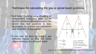 Technique for calculating the gap at spinal beam junctions
• Half beam blocking using shielding or
independent collimator jaws can be
used to eliminate divergence up to the
match line, but accuracy is then
dependent on precise immobilisation
and reliability of skin marks
• It can also be done by using a gap
between beams so that the beam
edges converge at a planned depth
Dodul Mondal
Image from Principles and Practice of Radiation Oncology, 6th Ed, Perez and Brady
 