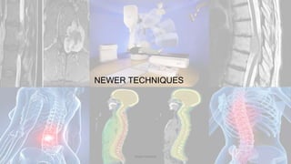 NEWER TECHNIQUES
Dodul Mondal
 