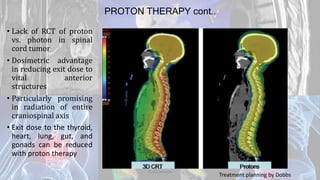 PROTON THERAPY cont..
• Lack of RCT of proton
vs. photon in spinal
cord tumor
• Dosimetric advantage
in reducing exit dose to
vital anterior
structures
• Particularly promising
in radiation of entire
craniospinal axis
• Exit dose to the thyroid,
heart, lung, gut, and
gonads can be reduced
with proton therapy
Dodul Mondal
Treatment planning by Dobbs
 